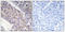 Beta-1,4-Galactosyltransferase 3 antibody, A09618T3-1, Boster Biological Technology, Immunohistochemistry paraffin image 