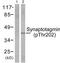 Synaptotagmin 1 antibody, TA314581, Origene, Western Blot image 