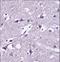 SEC22 Homolog B, Vesicle Trafficking Protein (Gene/Pseudogene) antibody, LS-C168929, Lifespan Biosciences, Immunohistochemistry paraffin image 