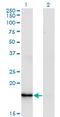 Zinc Finger Matrin-Type 4 antibody, MA5-22587, Invitrogen Antibodies, Western Blot image 