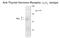 Thyroid Hormone Receptor Alpha antibody, GTX30163, GeneTex, Western Blot image 