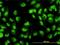 DExH-Box Helicase 9 antibody, H00001660-M01, Novus Biologicals, Immunocytochemistry image 