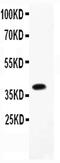 Caveolin 2 antibody, PA5-78927, Invitrogen Antibodies, Western Blot image 