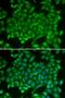 RAB11A, Member RAS Oncogene Family antibody, LS-C331314, Lifespan Biosciences, Immunofluorescence image 