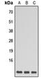 Erb-B2 Receptor Tyrosine Kinase 3 antibody, orb256520, Biorbyt, Western Blot image 