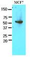 Glucose-6-Phosphate Dehydrogenase antibody, LS-B3587, Lifespan Biosciences, Western Blot image 