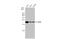 P53 Apoptosis Effector Related To PMP22 antibody, GTX135223, GeneTex, Western Blot image 