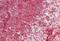 Integrin Subunit Alpha L antibody, MBS248637, MyBioSource, Immunohistochemistry paraffin image 