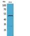 Tubulin alpha-1A chain antibody, STJ96795, St John