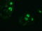 Zinc Finger Imprinted 2 antibody, TA501906, Origene, Immunofluorescence image 