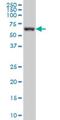 G Protein-Coupled Receptor Kinase 6 antibody, H00002870-M09, Novus Biologicals, Western Blot image 