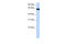 Phosphatidylinositol Glycan Anchor Biosynthesis Class W antibody, 30-511, ProSci, Enzyme Linked Immunosorbent Assay image 