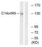 Spectrin Repeat Containing Nuclear Envelope Family Member 3 antibody, AP33271PU-N, Origene, Western Blot image 