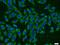 Ubiquitin Conjugating Enzyme E2 V2 antibody, 10689-1-AP, Proteintech Group, Immunofluorescence image 