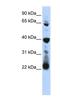 RNA Pseudouridine Synthase D3 antibody, NBP1-80483, Novus Biologicals, Western Blot image 