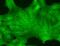 Transient Receptor Potential Cation Channel Subfamily M Member 2 antibody, MA5-27612, Invitrogen Antibodies, Immunofluorescence image 