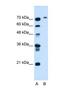 Butyrylcholinesterase antibody, NBP1-69541, Novus Biologicals, Western Blot image 