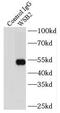 WD Repeat And SOCS Box Containing 2 antibody, FNab09527, FineTest, Immunoprecipitation image 