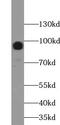 WW Domain Containing E3 Ubiquitin Protein Ligase 1 antibody, FNab09534, FineTest, Western Blot image 