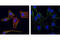 Tyrosine antibody, 9411S, Cell Signaling Technology, Immunocytochemistry image 