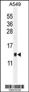 Keratinocyte Associated Protein 2 antibody, 55-688, ProSci, Western Blot image 