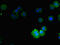 NADPH Oxidase 5 antibody, LS-C676176, Lifespan Biosciences, Immunofluorescence image 