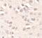 Aprataxin antibody, FNab10359, FineTest, Immunohistochemistry paraffin image 