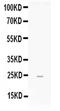 Fibroblast Growth Factor 19 antibody, PA5-79252, Invitrogen Antibodies, Western Blot image 