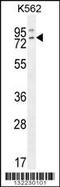 RAS Guanyl Releasing Protein 2 antibody, TA324479, Origene, Western Blot image 