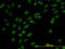 Nuclear Receptor Subfamily 3 Group C Member 1 antibody, LS-C197356, Lifespan Biosciences, Immunofluorescence image 
