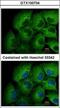 Matrix Metallopeptidase 12 antibody, GTX100704, GeneTex, Immunofluorescence image 