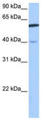 DEP Domain Containing 7 antibody, TA339913, Origene, Western Blot image 