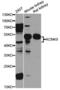 Potassium Two Pore Domain Channel Subfamily K Member 9 antibody, A8609, ABclonal Technology, Western Blot image 