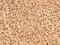 Inositol Polyphosphate-5-Phosphatase A antibody, LS-C318122, Lifespan Biosciences, Immunohistochemistry paraffin image 