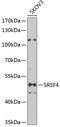 Serine And Arginine Rich Splicing Factor 4 antibody, 22-601, ProSci, Western Blot image 