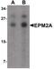 Laforin antibody, PA5-34436, Invitrogen Antibodies, Western Blot image 