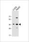 Engrailed Homeobox 1 antibody, GTX81554, GeneTex, Western Blot image 