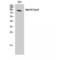 MER Proto-Oncogene, Tyrosine Kinase antibody, LS-C384506, Lifespan Biosciences, Western Blot image 