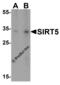 Sirtuin 5 antibody, 5771, ProSci Inc, Western Blot image 