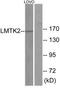 Lemur Tyrosine Kinase 2 antibody, TA315189, Origene, Western Blot image 