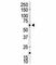 Ribosomal Protein S6 Kinase B2 antibody, F50952-0.4ML, NSJ Bioreagents, Western Blot image 