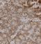 Phosphatidylinositol-5-Phosphate 4-Kinase Type 2 Gamma antibody, NBP1-92272, Novus Biologicals, Immunohistochemistry frozen image 