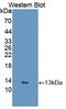 Resistin antibody, LS-C722561, Lifespan Biosciences, Western Blot image 