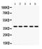 Tropomyosin 1 antibody, MA1095, Boster Biological Technology, Western Blot image 