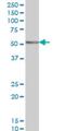 TACO antibody, H00011151-M01, Novus Biologicals, Western Blot image 