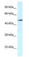 Vanin 2 antibody, NBP1-79906, Novus Biologicals, Western Blot image 