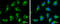 Pyruvate Dehydrogenase E1 Beta Subunit antibody, GTX104040, GeneTex, Immunocytochemistry image 