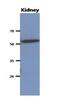 Carnosine Dipeptidase 2 antibody, GTX53703, GeneTex, Western Blot image 