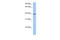 Medium-chain specific acyl-CoA dehydrogenase, mitochondrial antibody, 25-092, ProSci, Western Blot image 