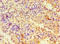 Carbonic Anhydrase 12 antibody, A55671-100, Epigentek, Immunohistochemistry paraffin image 